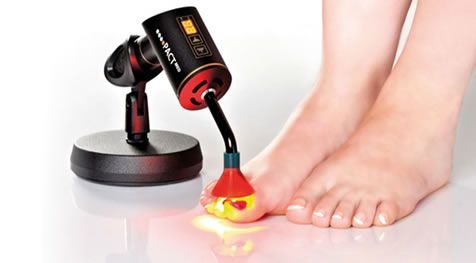 PACT Fungal Nail Laser Treatment